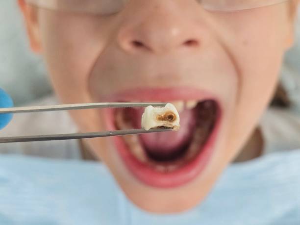 Best Pediatric Emergency Dentist in England, AR
